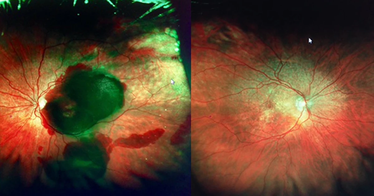 This is a photo of a lady I saw yesterday. She is 82 years old and suffers from emphysema.