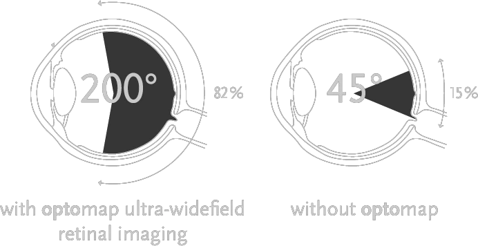 OPTOS Ultra-widefield imaging is now available at Northern Sydney Cataract and optomap is a part of our comprehensive eye exam.