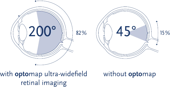 OPTOS Ultra-widefield imaging is now available at Northern Sydney Cataract and optomap is a part of our comprehensive eye exam.